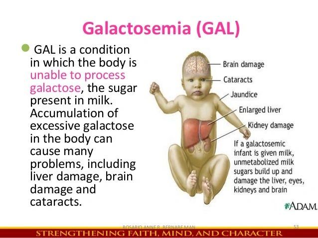 What is Galactosemia??